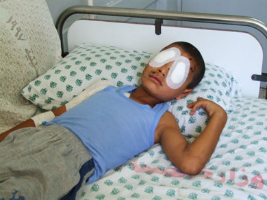 الطقل خميس أبو عرب بعد اصابته بجسم مشبوه