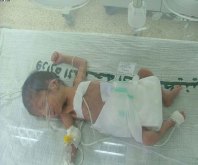 الحصار يحصد ارواح الاطفال 