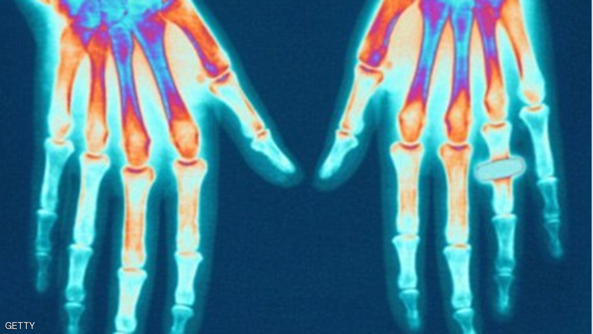 صورة "أرشيفية"