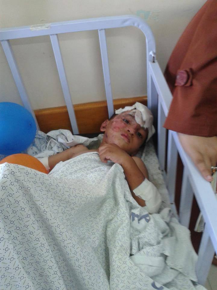 صورة لطفل أصيب بقذائف الاحتلال