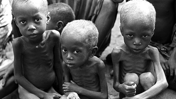 3 ملايين طفل يموتون سنويا بسبب نقص التغذية