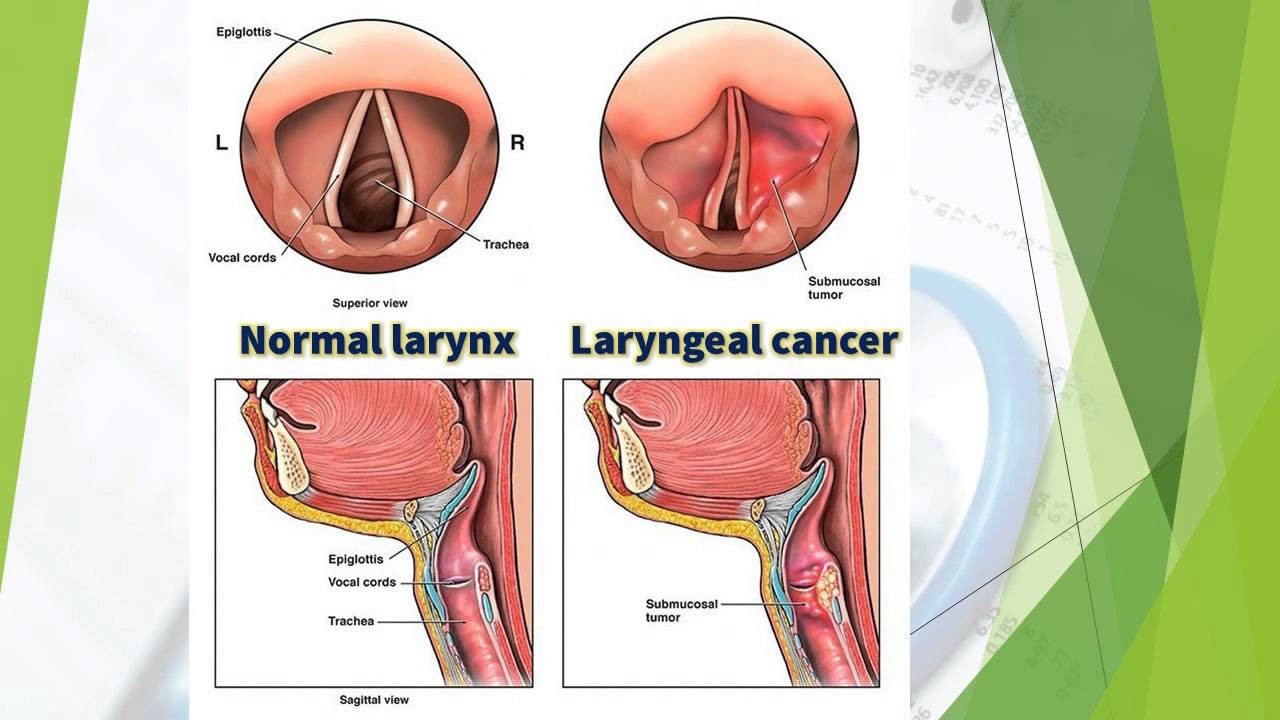 تمثل الحنجرة ذلك الجزء من الحلق الذي يوجد في مدخل القصبة الهوائية