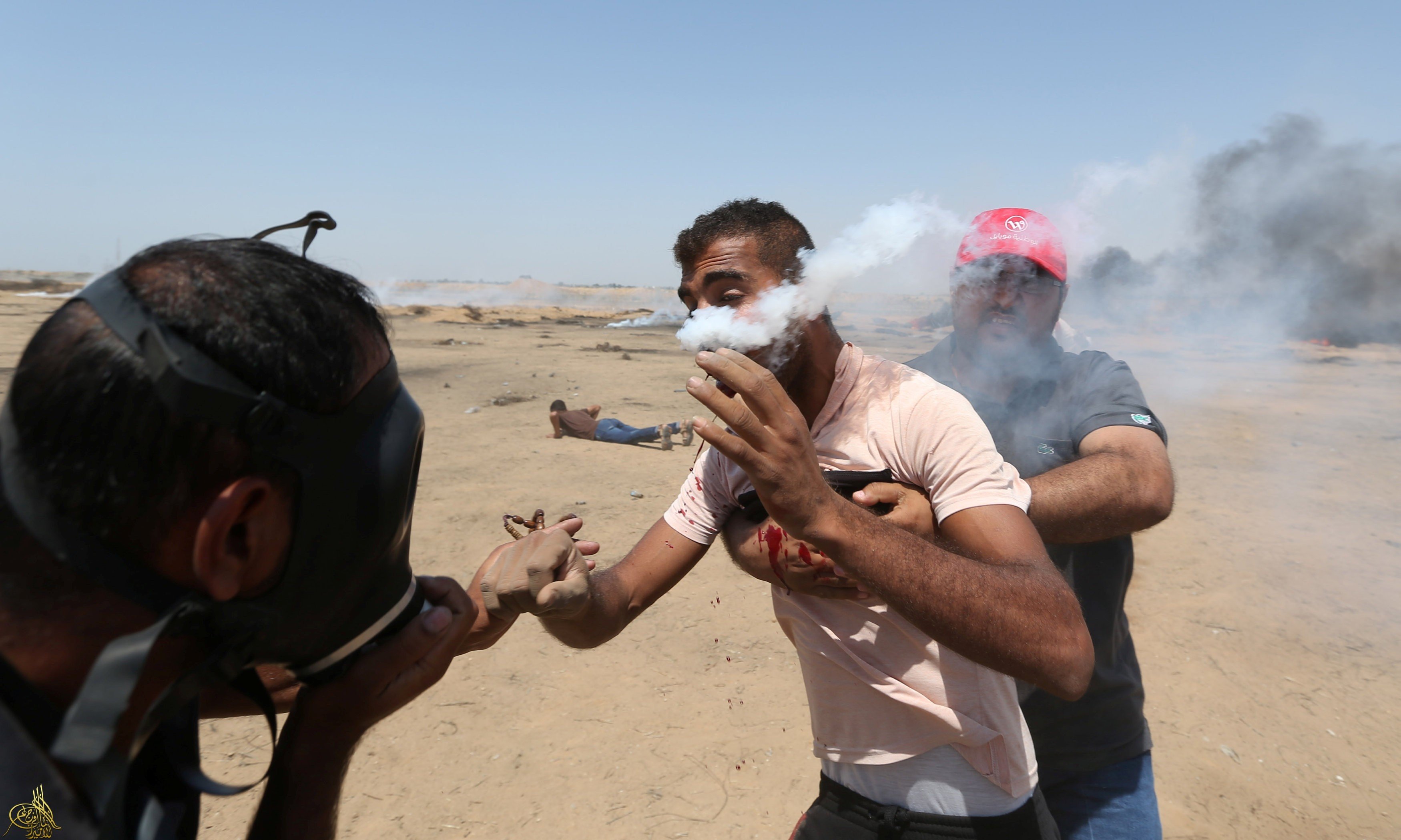 مصاب بقنبلة غاز