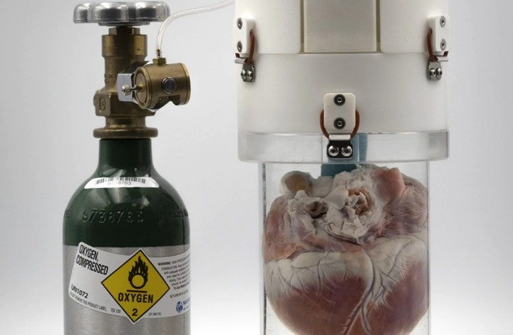 الإبقاء على قلب "شخص ميت" حي لـ24 ساعة.. إنجاز طبي جديد