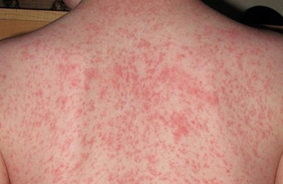 صورة "أرشيفية"