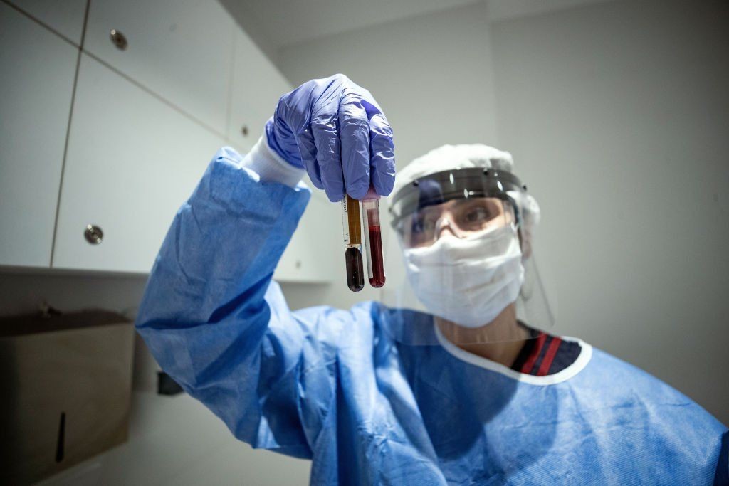 الصحة العالمية:لا يمكننا التظاهر بأن وباء كورونا قد انتهى