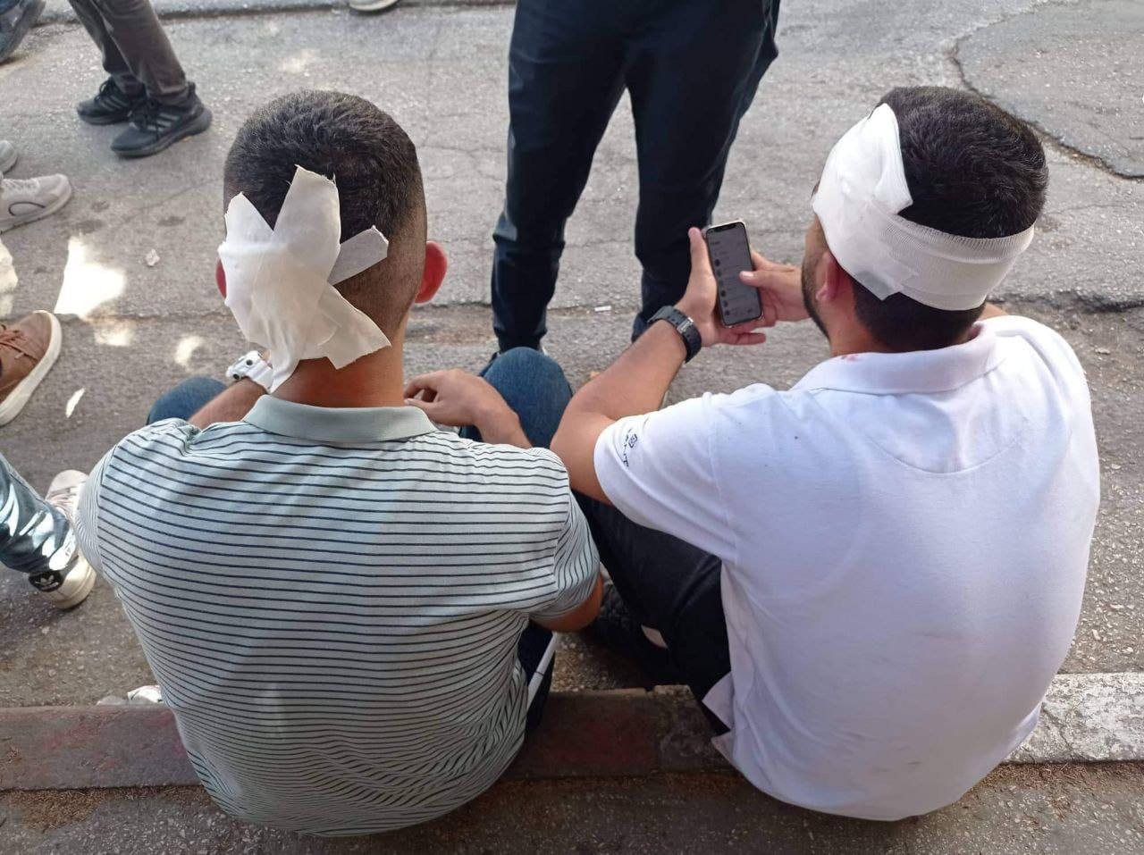 صورة لطالب جرى الاعتداء عليهم من قبل بلطجية أمن السلطة