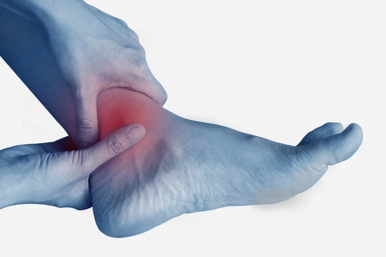 التواء الكاحل