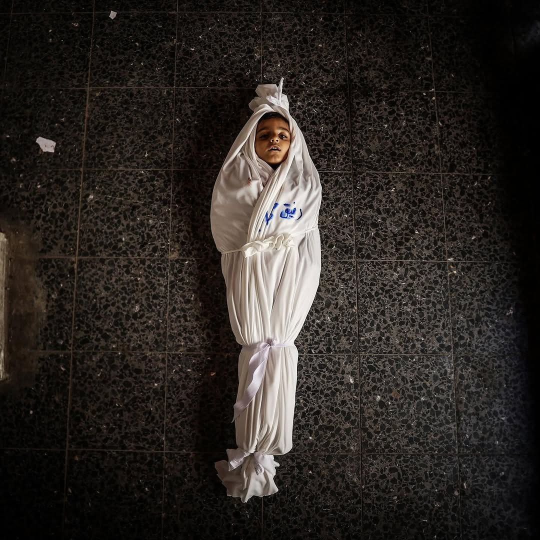 اليونيسف: أزمة إنسانية في غزة تهدد حياة الأطفال بسبب نقص المساعدات والمستلزمات الأساسية