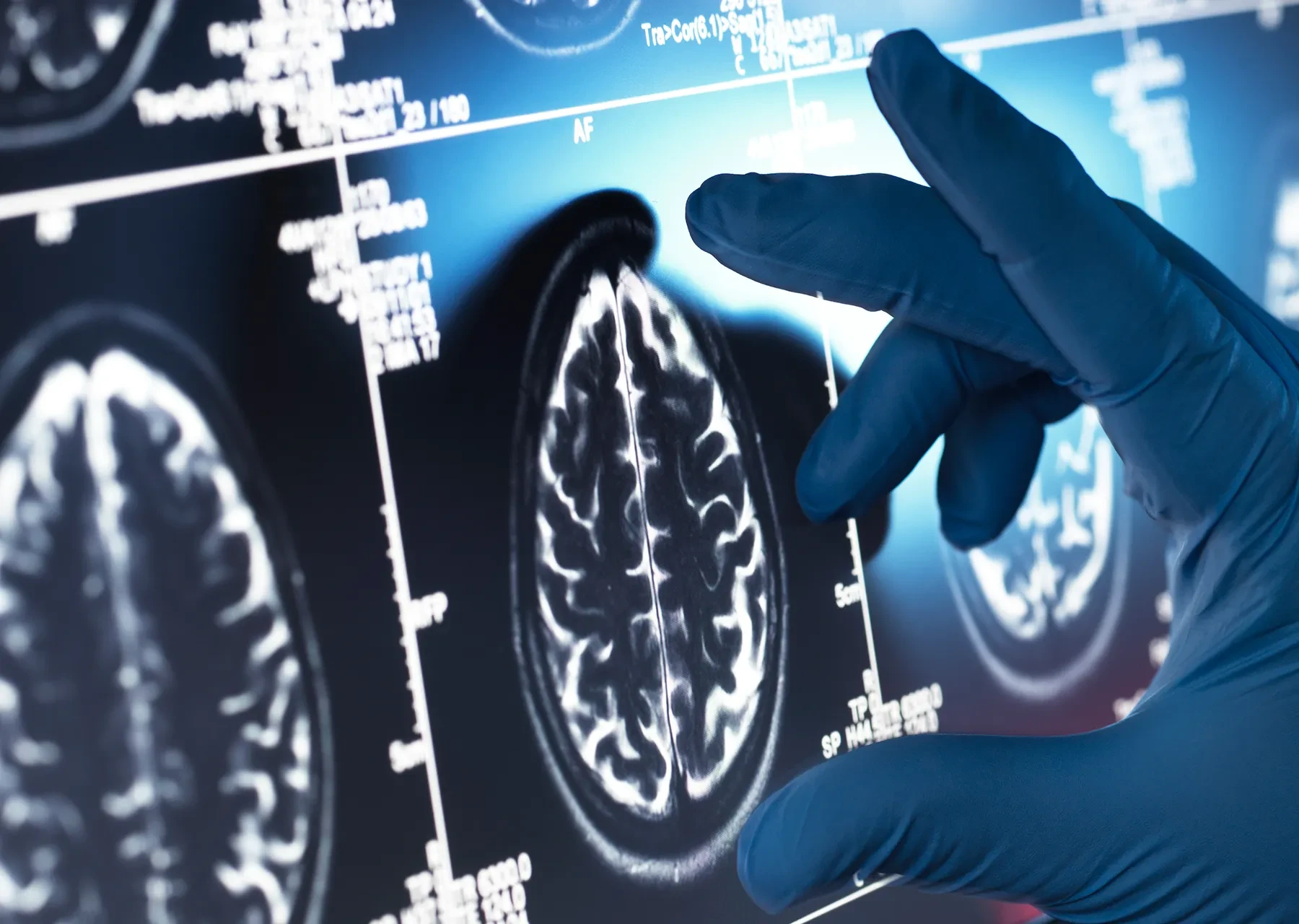 وزارة الصحة بغزة تعيد تشغيل أجهزة التصوير الطبي الملون