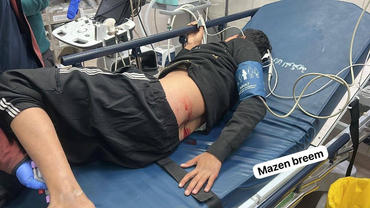 إصابة طفلين جراء إطلاق نار من الاحتلال في خانيونس جنوب قطاع غزة