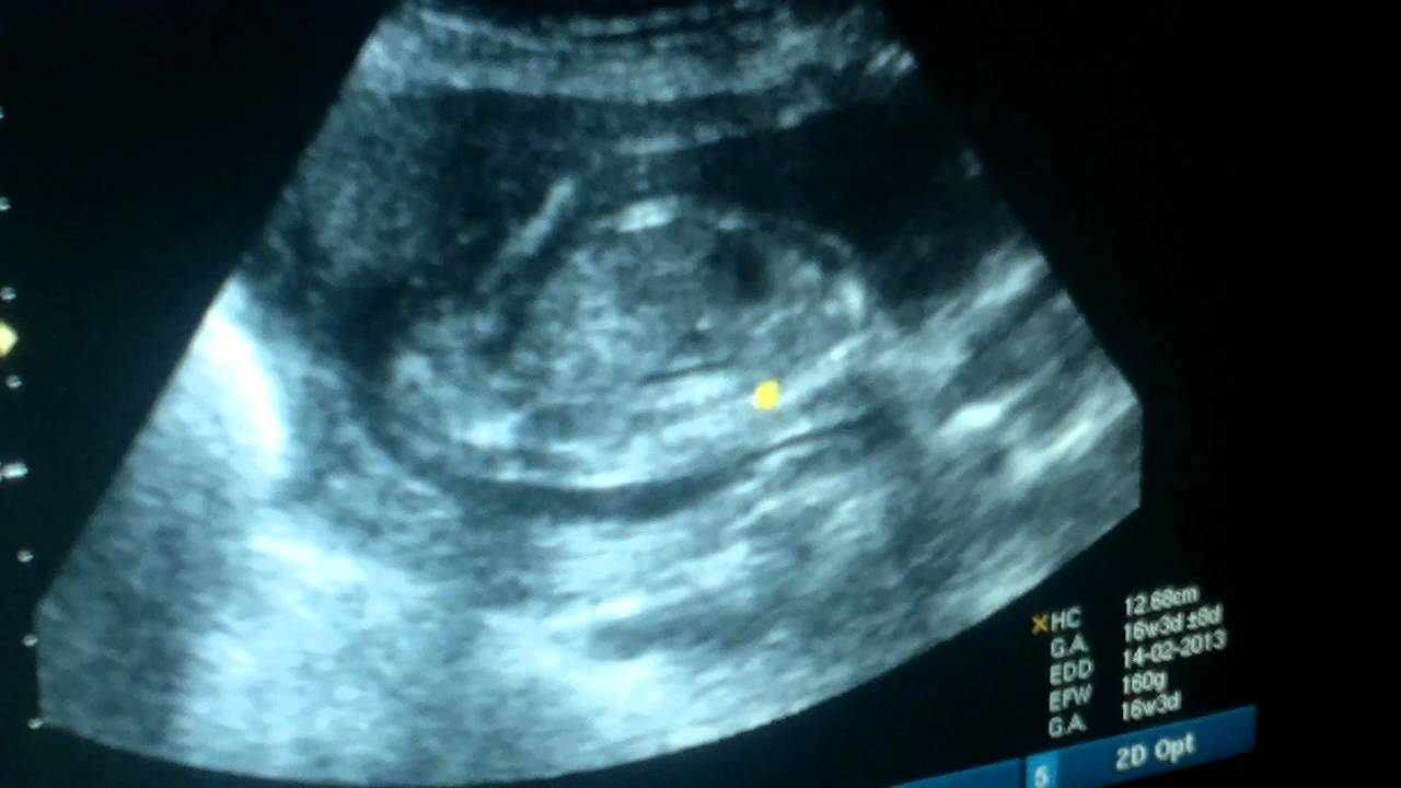 صورة توضيحية