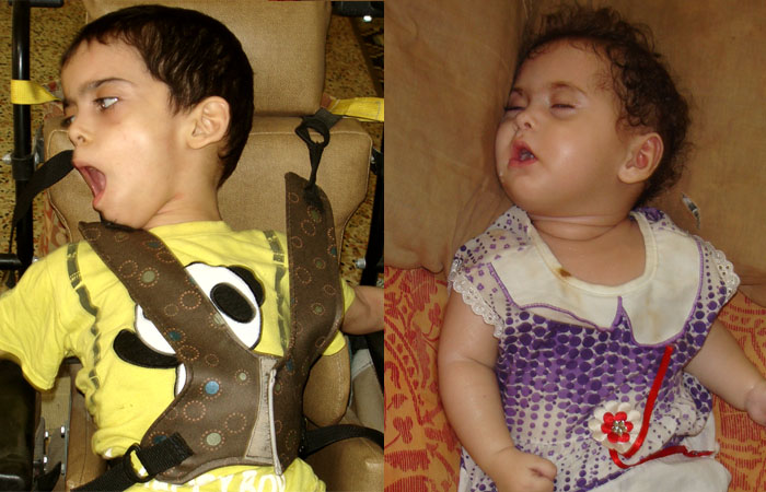 "سعيد ويسرا" براءة الأطفال تكبّلها الإعاقة