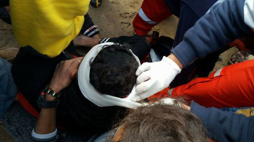 صورة للمصاب