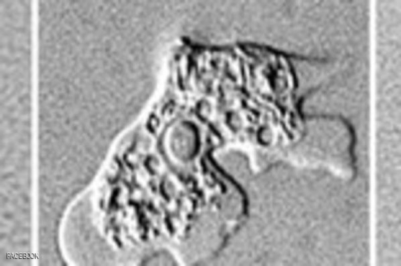 بكتيريا نادرة "تأكل" خلايا المخ