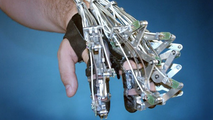 جهاز كمبيوتر عاقل يتحكم في أطراف اصطناعية