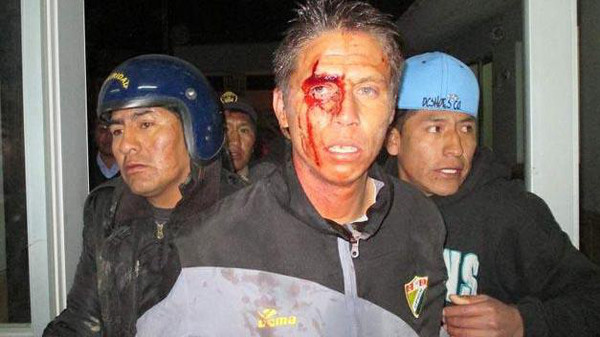 مارتن دالاورسو