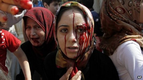 مصابات في قصف للنظام السوري (الأرشيف)