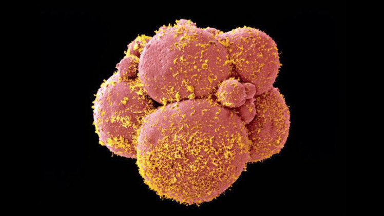 تجارب صينية لإدخال "تعديلات" على الأجنة البشرية تشعل جدلا أخلاقيا بين العلماء